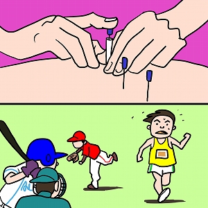 アスリートを支える鍼（ハリ）のチカラ