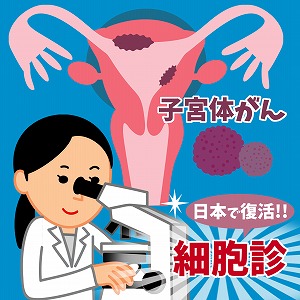 消えた診断法が日本で復活！　子宮体がん細胞診の挑戦